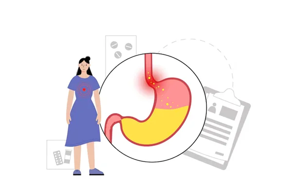 Esophageal Dysphagia