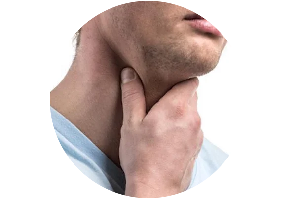Pharyngitis