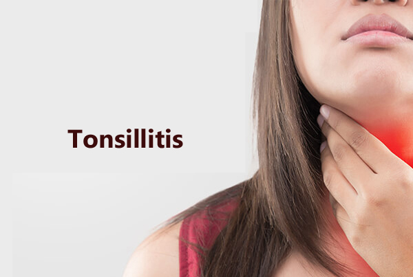 Tonsillitis