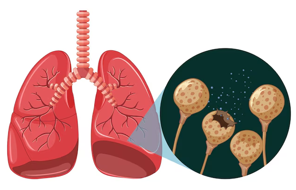 Nasopharyngeal Cancer